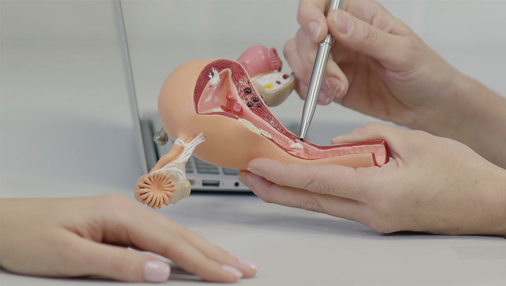 A doctor using a model of a vagina.